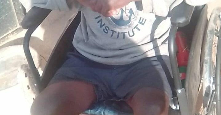 Family accuses Mpumalanga health department of neglect leading to grandfather’s leg rotting